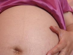 孕妇怎样预防长妊娠纹